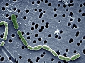 Oenococcus oeni. Foto © Wikipedia